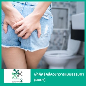 ผ่าตัดริดสีดวงทวารแบบธรรมดา (ดมยา)