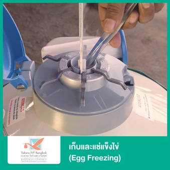 เก็บและแช่แข็งไข่ (Egg Freezing)