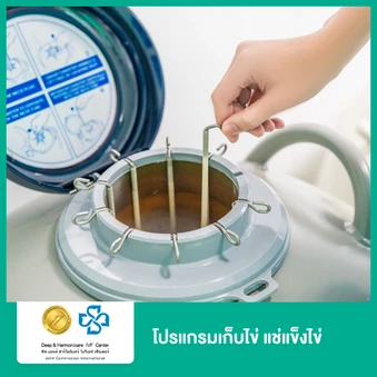 โปรแกรมเก็บไข่ แช่แข็งไข่