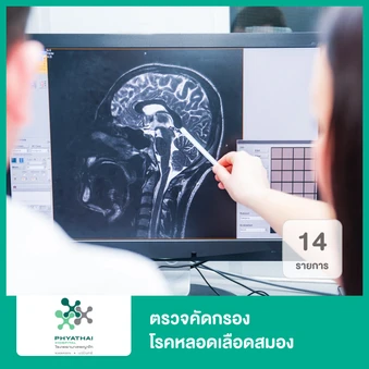 ตรวจคัดกรองโรคหลอดเลือดสมอง 18 รายการ (Stroke Screening Program)