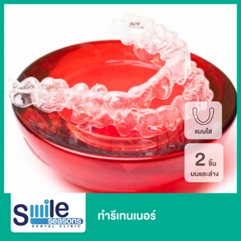 ทำรีเทนเนอร์แบบใส 2 ชิ้น ฟันบนและล่าง