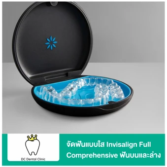 จัดฟันแบบใส Invisalign Full Comprehensive ฟันบนและล่าง