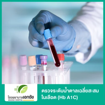 ตรวจระดับน้ำตาลเฉลี่ยสะสมในเลือด (Hb A1C)