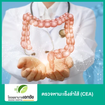 ตรวจหามะเร็งลำไส้ (CEA)