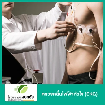 ตรวจคลื่นไฟฟ้าหัวใจ (EKG)