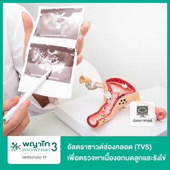 ตรวจรังไข่และมดลูกด้วยการอัลตราซาวด์ทางช่องคลอด (TVS) เพื่อตรวจหาเนื้องอก