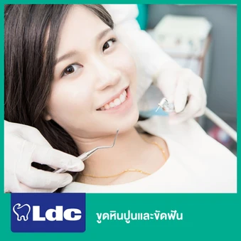 ขูดหินปูนและขัดฟัน