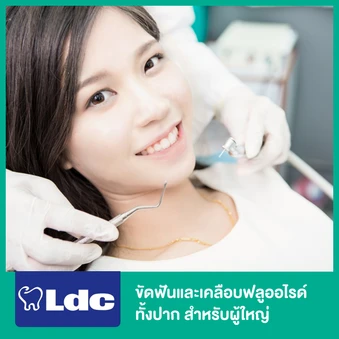 ขัดฟันและเคลือบฟลูออไรด์ทั้งปาก สำหรับผู้ใหญ่