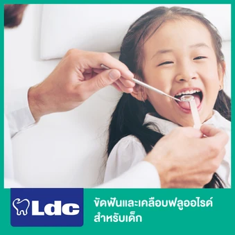 ขัดฟันและเคลือบฟลูออไรด์ สำหรับเด็ก