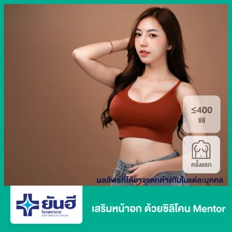 เสริมหน้าอก ด้วยซิลิโคน Mentor รุ่น X-TRA Gel ขนาดไม่เกิน 400 ซีซี สำหรับเคสทำครั้งแรก