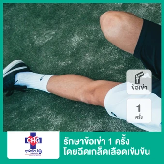 รักษาข้อเข่า ด้วยการฉีดเกล็ดเลือดเข้มข้น (PRP) 1 ครั้ง