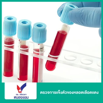 ตรวจการแข็งตัวของหลอดเลือดแดง (ABI)