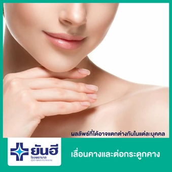 เลื่อนคางและต่อกระดูกคาง พักฟื้นที่รพ. 2 คืน