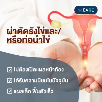 ผ่าตัดรังไข่และท่อนำไข่ทั้ง 2 ข้างออก