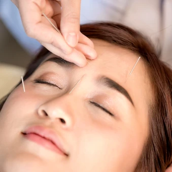 ฝังเข็ม มาส์กหน้า และทำกัวซาหน้า เพื่อผิวดูกระจ่างใส 1 ครั้ง