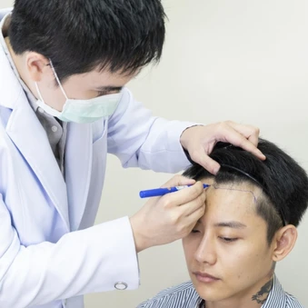 ปลูกผม ด้วยเทคนิค FUE ไม่เกิน 1,500 กราฟต์