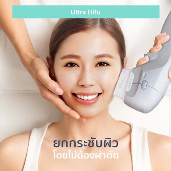 ทำ HIFU ด้วยเครื่อง Ultraformer III 300 ช็อต เพื่อยกกระชับ ปรับรูปหน้า 1 ครั้ง