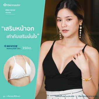 เสริมหน้าอก ด้วยซิลิโคน Mentor รุ่น Smooth Round จำนวนซีซีขึ้นอยู่กับแพทย์ประเมิน