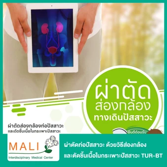 ผ่าตัดท่อปัสสาวะ ด้วยวิธีส่องกล้อง และตัดชิ้นเนื้อในกระเพาะปัสสาวะ TUR-BT นอนพักที่ รพ. 2 วัน 1 คืน