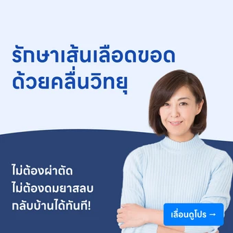 รักษาเส้นเลือดขอด ด้วยคลื่นวิทยุ RFA