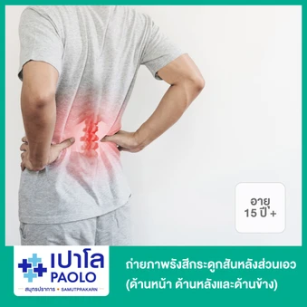 ถ่ายภาพรังสีกระดูกสันหลังส่วนเอว (ด้านหน้า ด้านหลังและด้านข้าง) สำหรับผู้ที่อายุ 15 ปีขึ้นไป