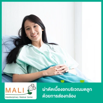 ผ่าตัดเนื้องอกบริเวณมดลูก ด้วยการส่องกล้อง