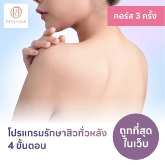 คอร์สโปรแกรมรักษาสิวทั่วแผ่นหลัง 4 ขั้นตอน 2 ครั้ง ฟรี! 1 ครั้ง