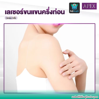 เลเซอร์ Dynamic Tech กำจัดขน (เลือก 1 จุด แขนบน/แขนล่าง) 1 ครั้ง (ราคาทดลอง)