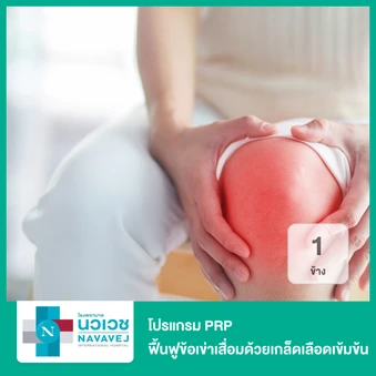 โปรแกรม PRP ฟื้นฟูข้อเข่าเสื่อมด้วยเกล็ดเลือดเข้มข้น 1 ข้าง
