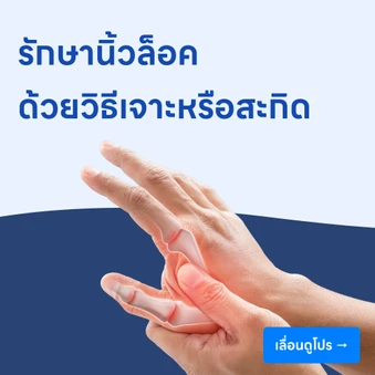 รักษานิ้วล็อค ด้วยวิธีเจาะหรือสะกิด