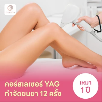 คอร์สเลเซอร์กำจัดขนขา 12 ครั้ง ด้วย YAG Laser