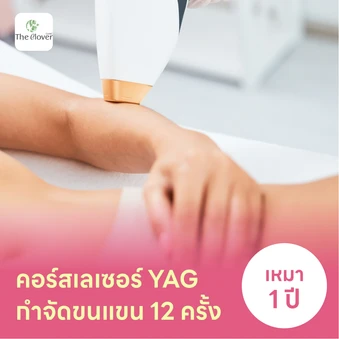 คอร์สเลเซอร์กำจัดขนแขน 12 ครั้ง ด้วย YAG Laser