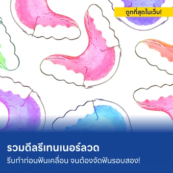 ทำรีเทนเนอร์ลวด ทนทาน ไม่ต้องเปลี่ยนบ่อย การันตีราคาถูกที่สุดในเว็บ