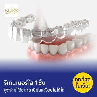 ทำรีเทนเนอร์แบบใส 1 ชิ้น
