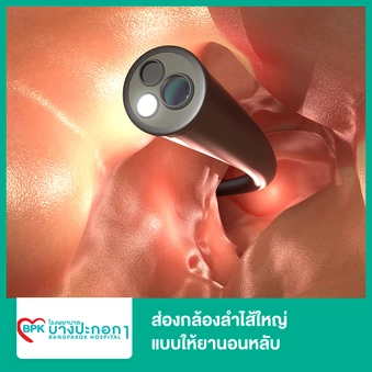 ส่องกล้องลำไส้ใหญ่ แบบให้ยานอนหลับ