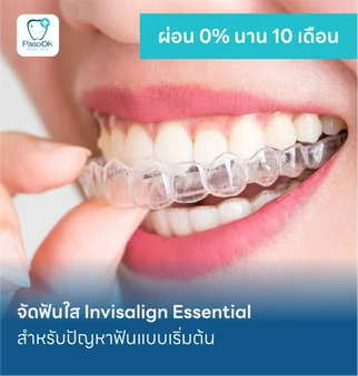 จัดฟันใส Invisalign Essential