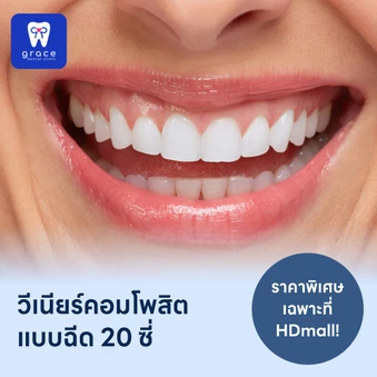 ทำวีเนียร์คอมโพสิตแบบฉีด 20 ซี่