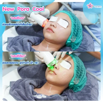 ทำทรีตเมนต์ New Pora Cool เติมวิตามินผิว ให้ผิวแข็งแรง กระจ่างใส ชุ่มชื้น รูขุมขนดูเล็กลง 1 ครั้ง