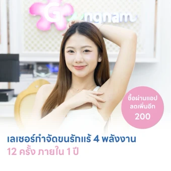 คอร์สเลเซอร์กำจัดขนรักแร้ 4 พลังงาน เครื่องแท้ Primelase จากสเปน 12 ครั้ง ภายใน 1 ปี (1 สิทธิ์/ท่าน)