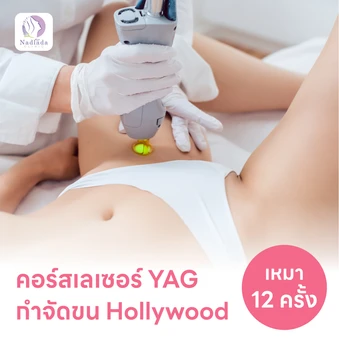 คอร์สเลเซอร์กำจัดขนน้องสาวแบบ Hollywood (vVIO) 12 ครั้ง ด้วย YAG Laser (ผู้หญิงเท่านั้น)