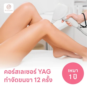 คอร์สเลเซอร์กำจัดขนขา 12 ครั้ง ด้วย YAG Laser