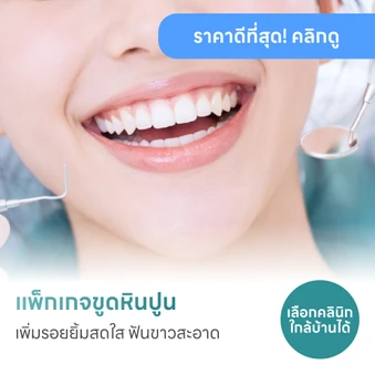 รวมโปรขูดหินปูน เลือกทำใกล้บ้านได้