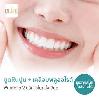 ขูดหินปูน + เคลือบฟลูออไรด์