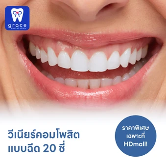 ทำวีเนียร์คอมโพสิตแบบฉีด 20 ซี่