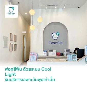 ฟอกสีฟัน ด้วยระบบ Cool Light รับบริการเฉพาะวันพุธเท่านั้น