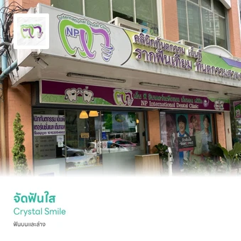 จัดฟันใส Crystal Smile สำหรับปรับฟันหน้าเล็กน้อย ฟันบนและล่าง