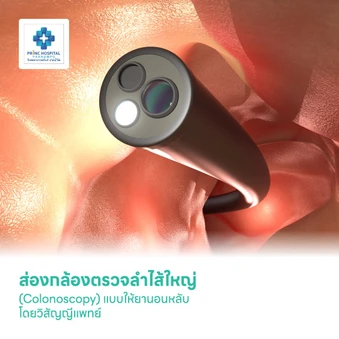 ส่องกล้องตรวจลำไส้ใหญ่ (Colonoscopy) แบบให้ยานอนหลับ โดยวิสัญญีแพทย์