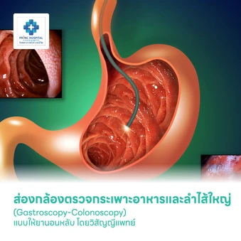 ส่องกล้องตรวจกระเพาะอาหารและลำไส้ใหญ่ (Gastroscopy-Colonoscopy) แบบให้ยานอนหลับ โดยวิสัญญีแพทย์
