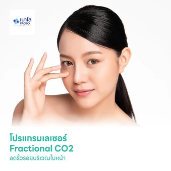 โปรแกรมเลเซอร์ Fractional CO2 ลดริ้วรอยบริเวณใบหน้า