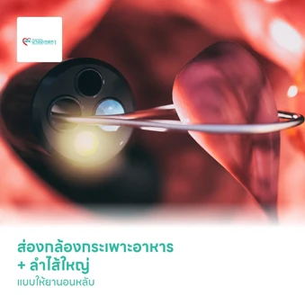ส่องกล้องกระเพาะอาหาร + ลำไส้ใหญ่ แบบให้ยานอนหลับ